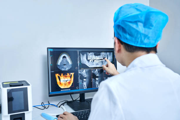 Best Emergency Tooth Extraction in Palmdale, CA